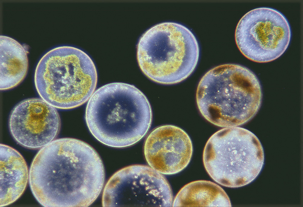 Diatomées Coscinodiscus au microscope optique ; Diamètre moyen: 60 µm. Crédit : Jean Lecomte / Biosphoto 